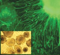 Neuron differentiation of embryonic stem cells in Millicell 24 1 µm PET filter plates. Murine embryonic stem cells were formed into suspended embryoid bodies (EBs) then transferred to 1 µm PET Millicell 24 for attachment and differentiation. Neural differentiation after retinoic acid treatment of attached EBs was confirmed by anti-neurofilament immunofluoresence. (Insert: Inverted phase contrast imaging through membrane of live EBs in media.)